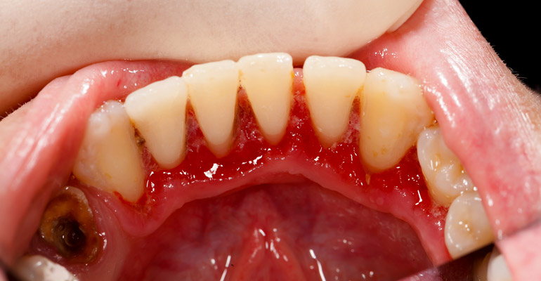 dentist la jolla